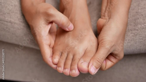 Closeup of female holding her painful feet and massaging her bunion toes to relieve pain. Swollen bunion at the edge of the big toe causes deformity (Hallux valgus). Woman's health concept. photo