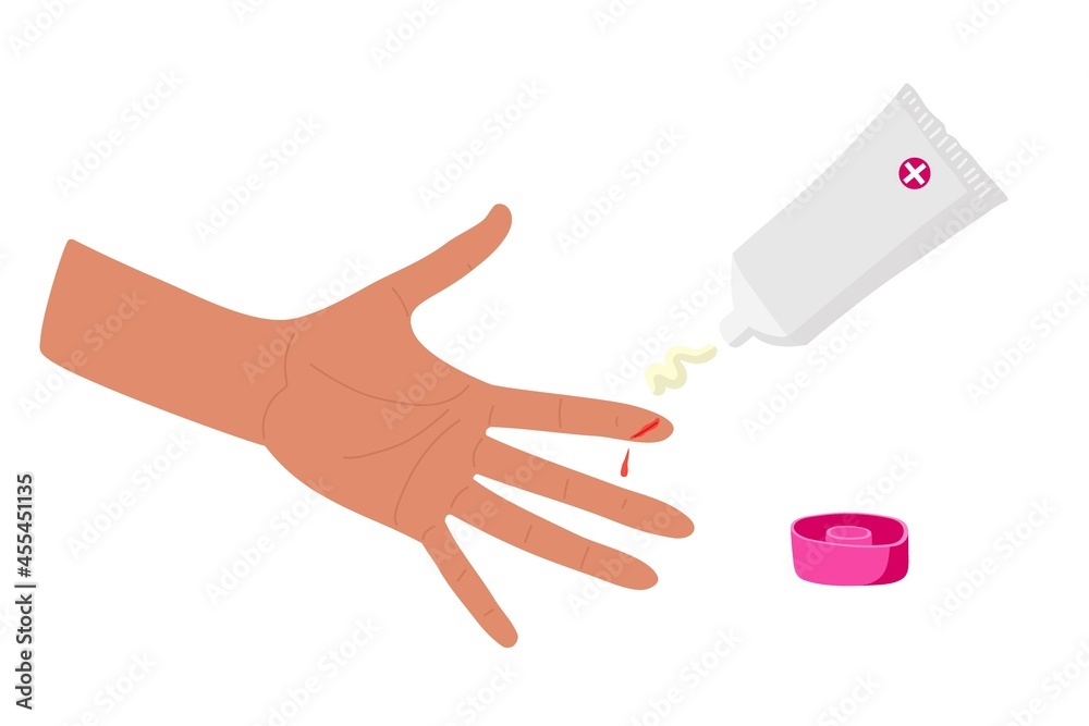 Physical injury. First aid for cuts. Application of antibacterial and