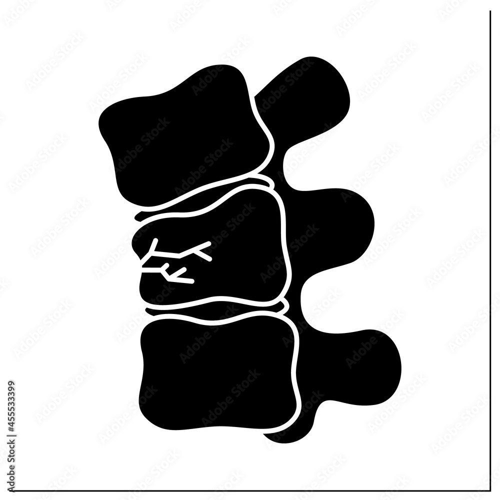 Compression fracture glyph icon. Crush. Vertebral collapseTrauma or ...