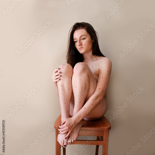 Woman sitting on brown stool with dots on her body photo