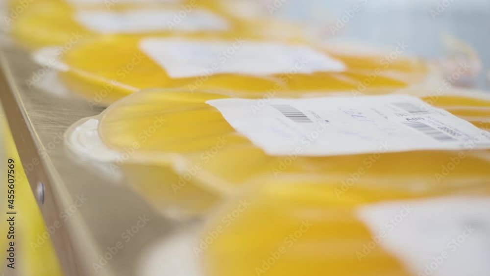 Close-up view of plastic bags with blood plasma in medical facility. Taking blood from patients in order to extract plasma from blood. Concept of helping people and humanity during COVID-19