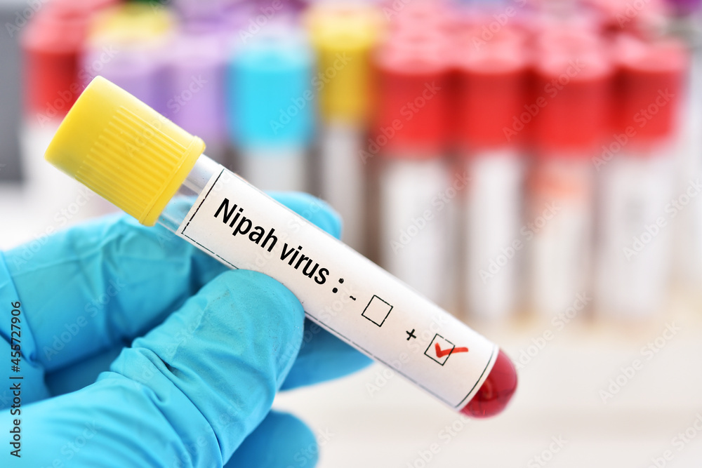 Fototapeta premium Blood sample tube positive with Nipah virus test