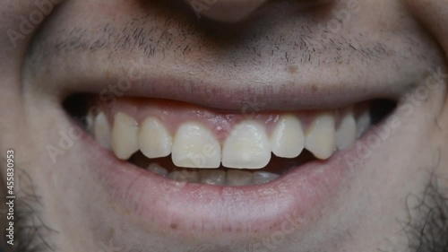 Man's mouth smiling naturally showing his theet, white skin and beard. Detailed view.  photo