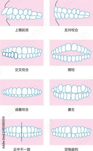 プリント