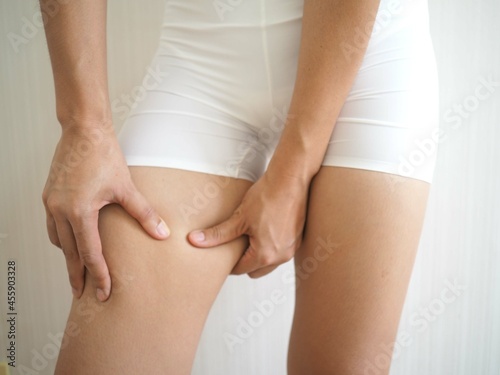 Woman squeezes cellulite skin on her thigh or leg. closeup photo, blurred.