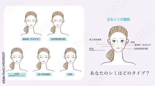肌の悩みのイラスト