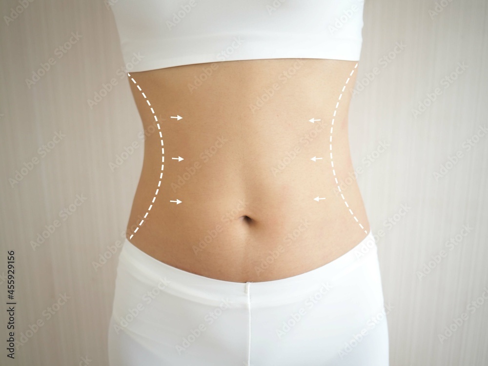 Fototapeta premium Positioning concept to get rid of fat and cellulite. overweight woman body with stripes and arrows on a white background. closeup photo, blurred.