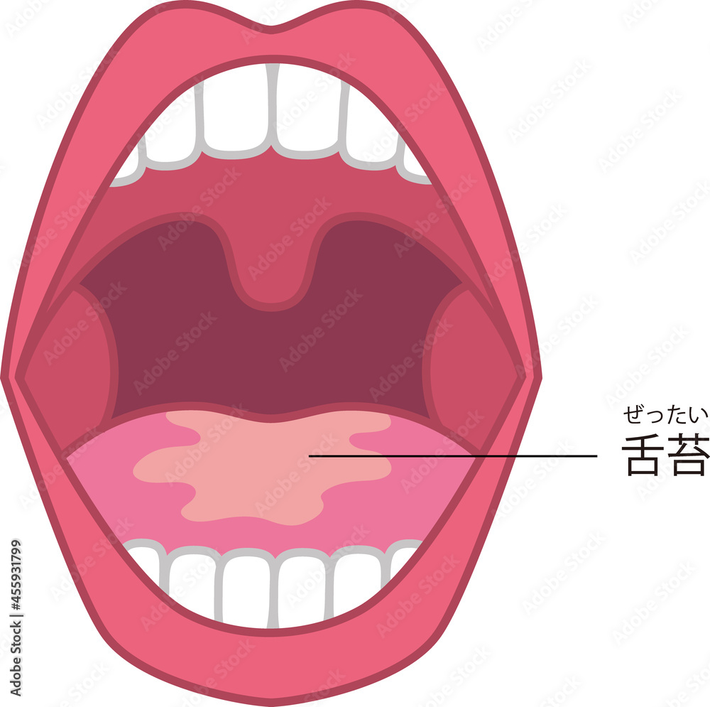 口臭のイラスト Stock Vector Adobe Stock 口臭のイラスト Stock Vector Adobe Stock