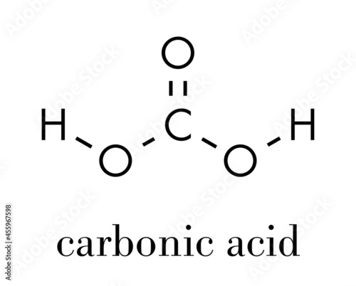 Carbonic acid molecule. Formed when carbon dioxide is dissolved in water (carbonated water). Skeletal formula.