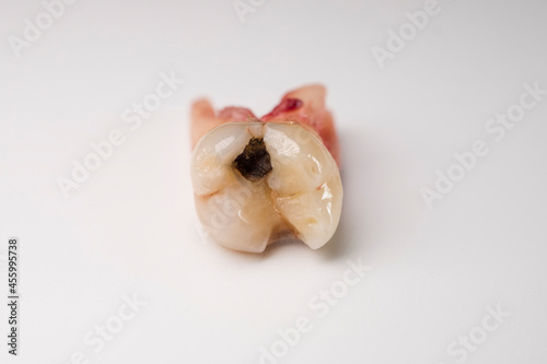 Fototapeta Naklejka Na Ścianę i Meble -  Close up of a tooth with a bit of blood stain on a white background.