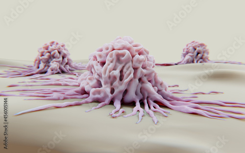 Behang Cancer cells migrating