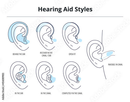Types of hearing aids for the hearing impaired and the deaf.Different hearing aid technology.Vector flat illustration