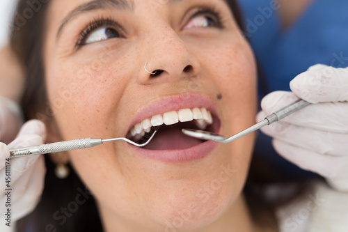 Close up view of dentist treating teeth of hispanic woman in dentist office