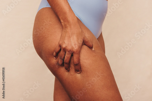 Closeup of an anonymous woman grabbing her thigh in a studio photo