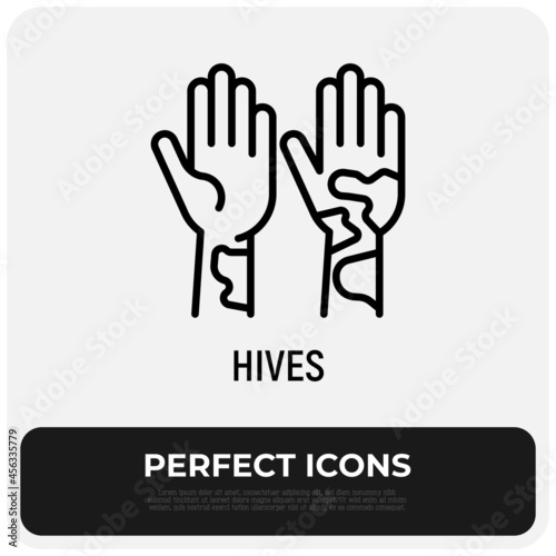Hives on hand thin line icon. Allergy symptom. Modern vector illustration of allergic reaction.