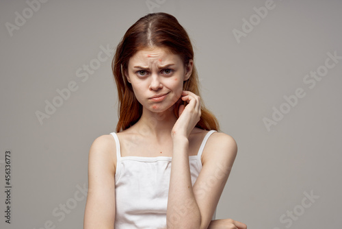  beautiful woman in a white t-shirt pimples on the face isolated background