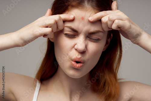 beautiful woman in a white t-shirt pimples on the face light background