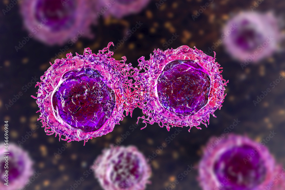 Fotografie Cancer cells, 3D illustration