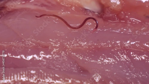 魚に寄生するシュードテラノーバ　	アニサキス症のイメージ素材