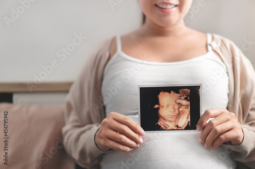 Asian pregnant woman holding ultrasound 4d scan image, Expectation of a child and Maternity prenatal care and woman pregnancy concept.