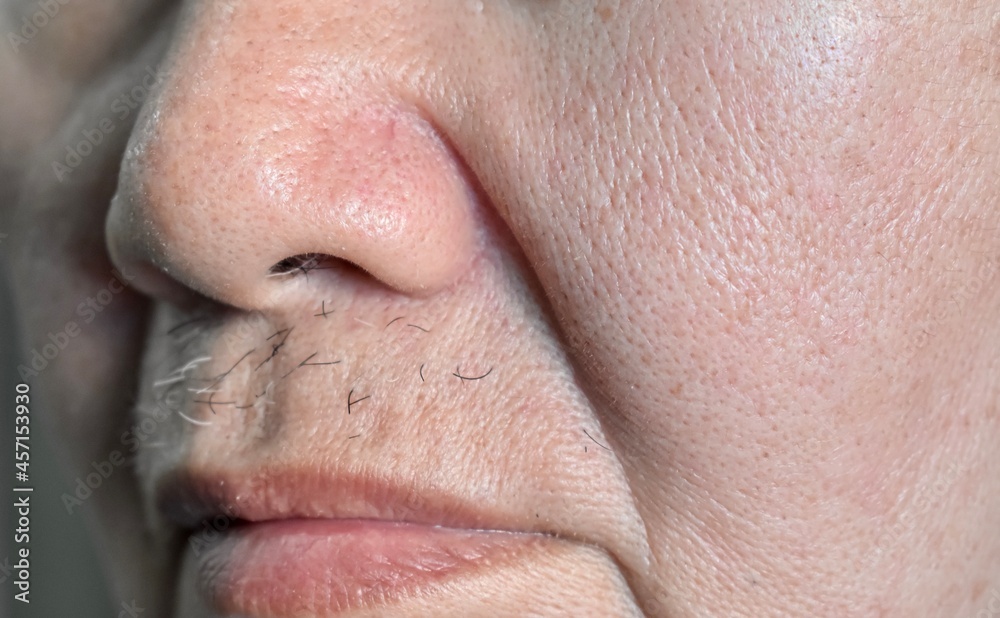 Enlarged pores in face of Asian, elder man with skin folds. Enlarged pores in face of Asian, elder man with skin folds.