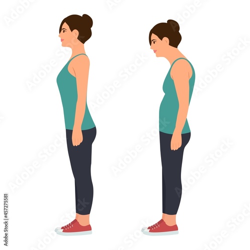 Correct and incorrect standing posture.Cervical spinal curvature. Hump.Healthy back.Vector illustration on white background.