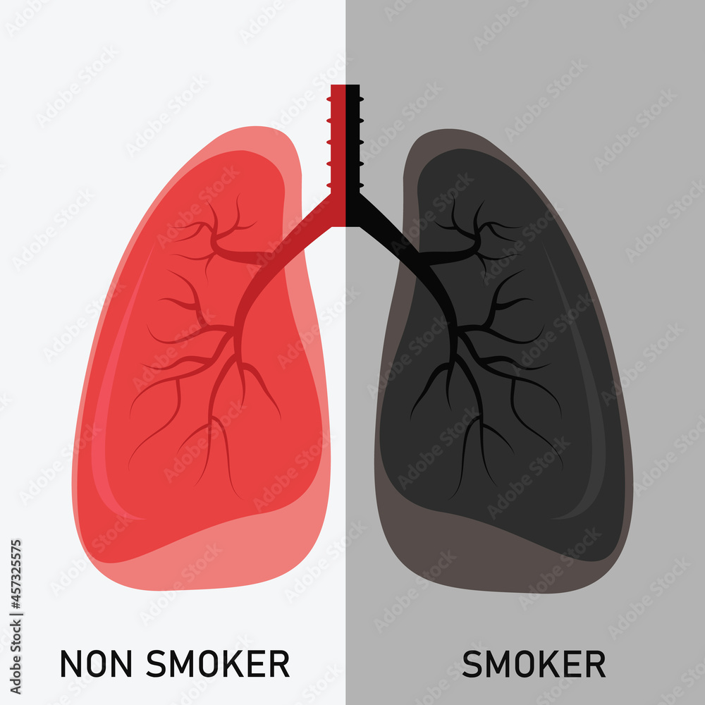 Smoker and Non Smoker lung vector Stock Vector Adobe Stock