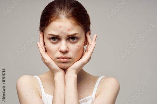 beautiful woman facial skin problems dermatology isolated background