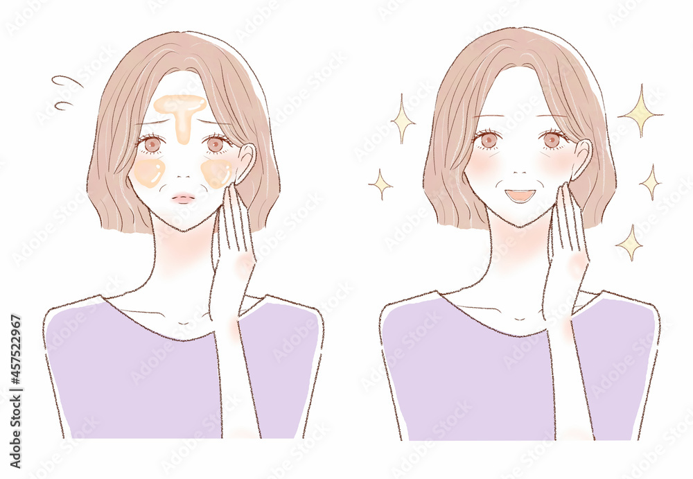 脂性肌（オイリー肌）に悩む中年女性のビフォーアフター