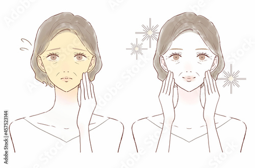 肌のくすみに悩む中年女性のビフォーアフター