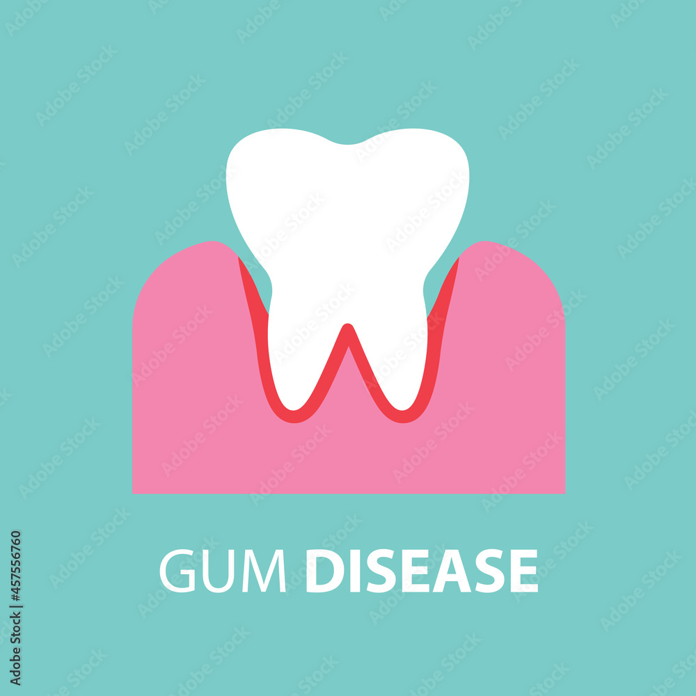 gum disease concept- vector illustration Stock Vector | Adobe Stock