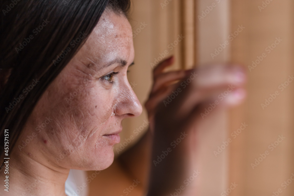 Close up photo of woman with dry skin looking in the window. Close up photo of woman with dry skin looking in the window.
