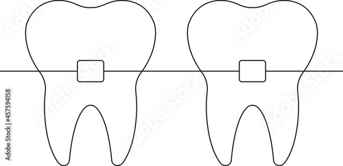 dental braces  and dental