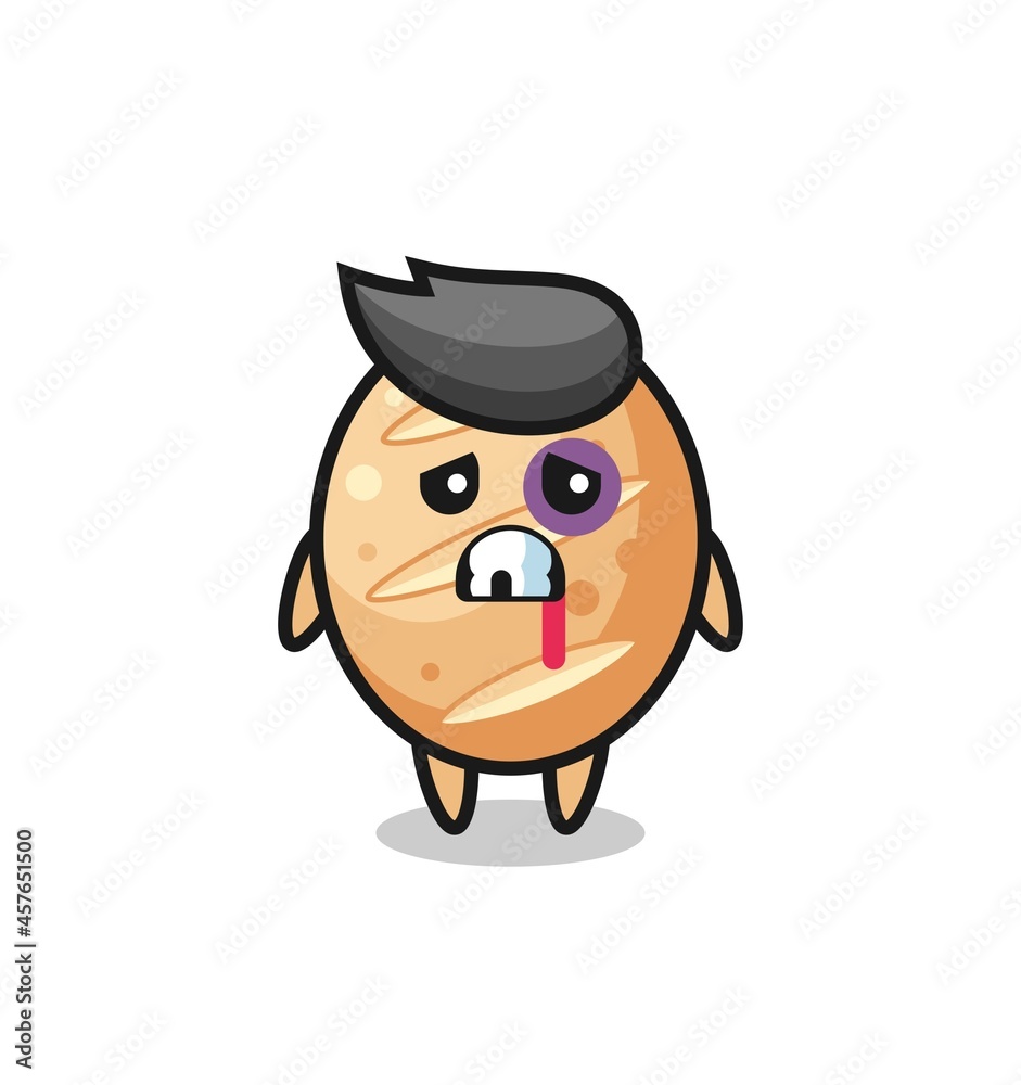 injured french bread character with a bruised face