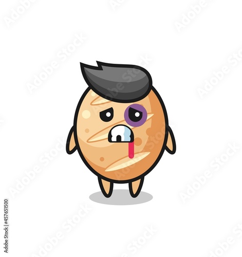 injured french bread character with a bruised face