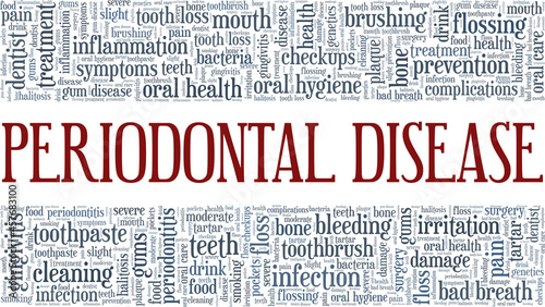 Periodontitis - Periodontal Disease vector illustration word cloud isolated on white background.