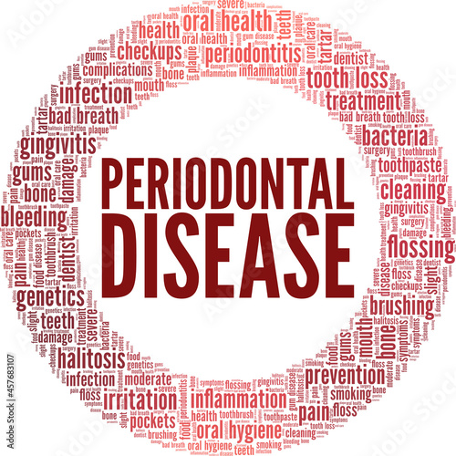 Periodontitis - Periodontal Disease vector illustration word cloud isolated on white background.