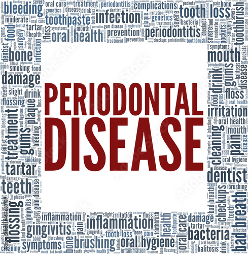 Periodontitis - Periodontal Disease vector illustration word cloud isolated on white background.
