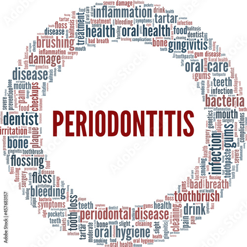 Periodontitis - Periodontal Disease vector illustration word cloud isolated on white background.