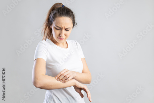Young woman scratching her itchy arm. photo