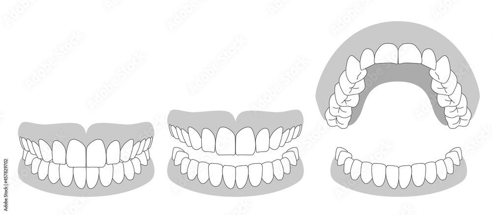 第一大臼歯 第一大臼歯 Images – Browse 55 Stock Photos, Vectors, and