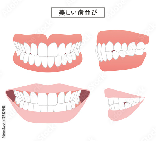 美しい歯並び　セットイラスト