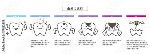 シンプル　イラスト　虫歯の進行　歯のキャラクター photo