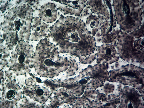 Histology image of compact osseous (bone) tissue showing osteons and osteocytes (100x) photo