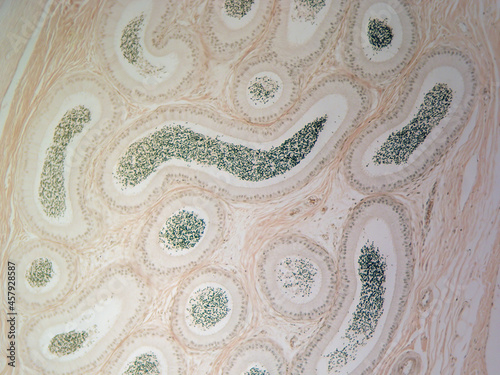 Histology image of epididymis showing sperm storage and simple columnar epithelia (100x) photo