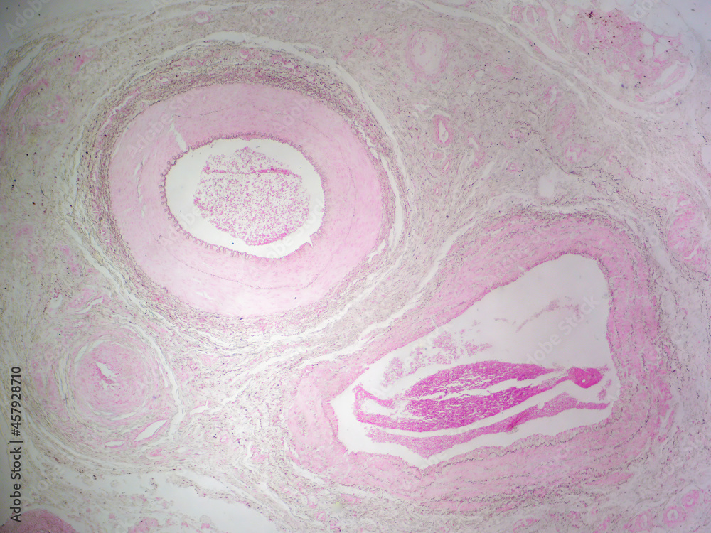 Histology image showing an artery, vein, and nerve (40x) Stock Photo