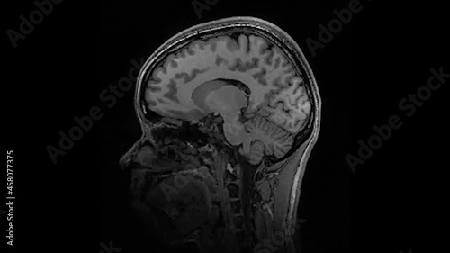 Human brain MRI on Black Background 4k footage