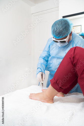 Toenail fungus treatment with foot laser at laser nail therapy clinic