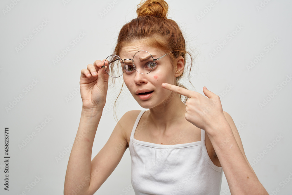 woman in a white t-shirt with glasses pimples on her face