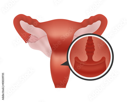 Realistic female human reproductive system on white background focus on cervix. Reproductive system with close-up cross-section